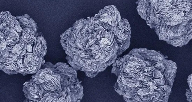 ɭ��������-׷�󿵽�,����һ������